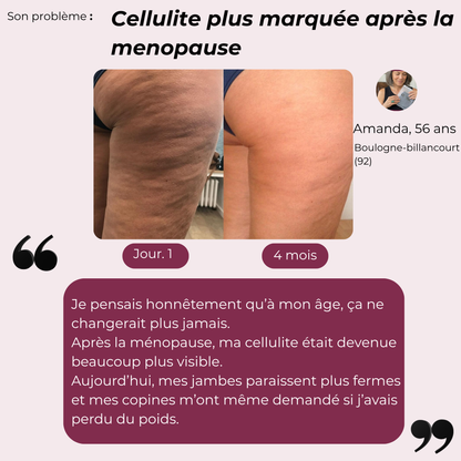 Legging Anti-cellulite